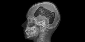 Dependence on video games have made a medical diagnosis