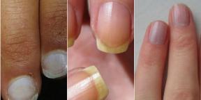 Look at your nails. 12 These deviations can tell a lot about your health