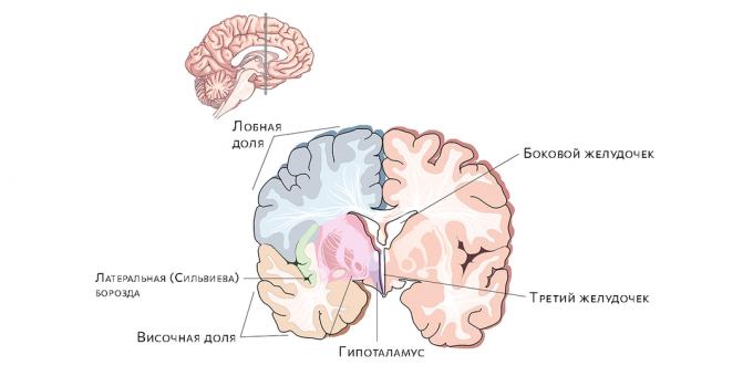 Brain ventricles. The accumulation of fluid in them leads to hydrocephalus.