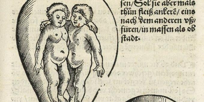 Children of the Middle Ages: Twins in the Womb, Eucharius Rodion