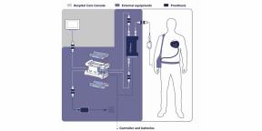 Successful Aeson Artificial Heart Transplant