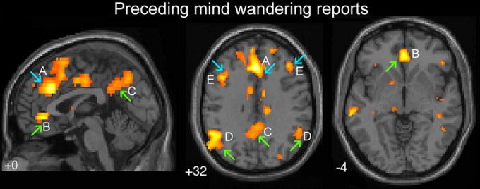Green arrows indicate areas of the brain responsible for "automatic behavior". Blue arrow - the "executive" part of the brain. A - dorsal cingulate, B - ventralanya cingulate, C - precuneus cerebral hemispheres, D - bilateral temporoparietal junction, E - dorsolateral prefrontal cortex