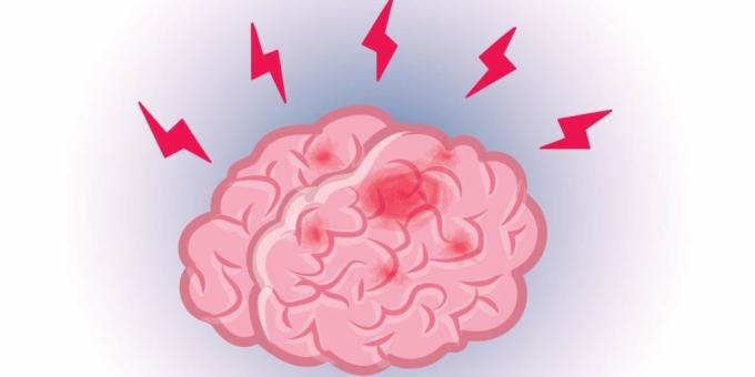 facts about the brain: Pain