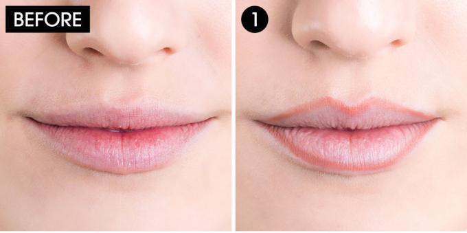 How to reduce the lip