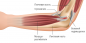 Where does elbow pain come from and what to do about it