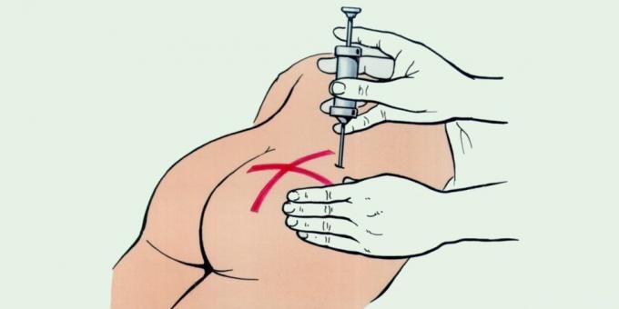 How to prick: the right place for injection